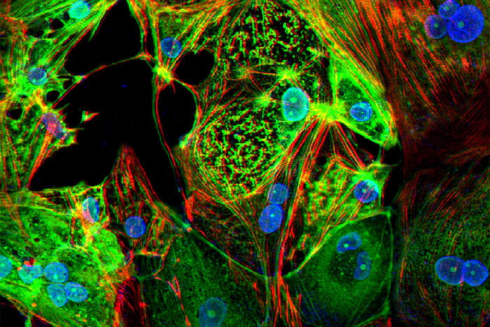 Engineered heart tissue showing how muscle cells (red) are infected with SARS-CoV-2